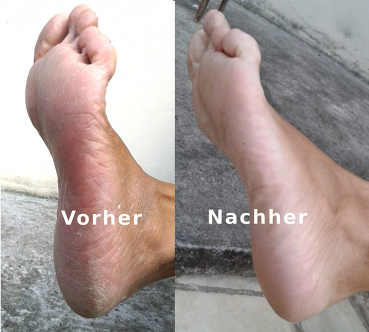 Mosadal Fußpflege Profi Set 4 teilig mit 2 x Lotion 250 ml, 1 x Creme Hydratante mit Urea, 1 x Fußwanne